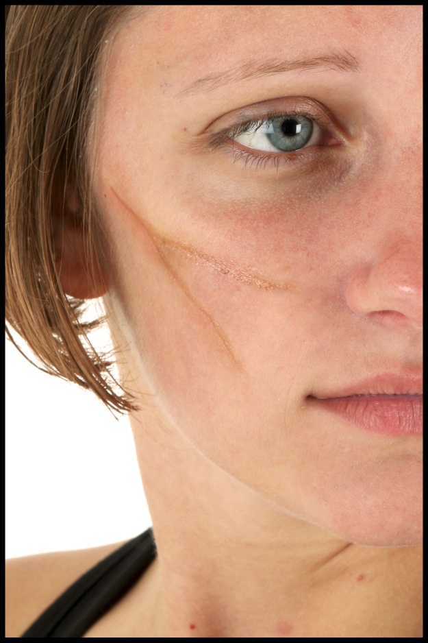 Ansøgning Slange justering 3 DIY Halloween Makeup Effects: Basic Scar, Black Eye, and Frost Bite -  HalloweenCostumes.com Blog