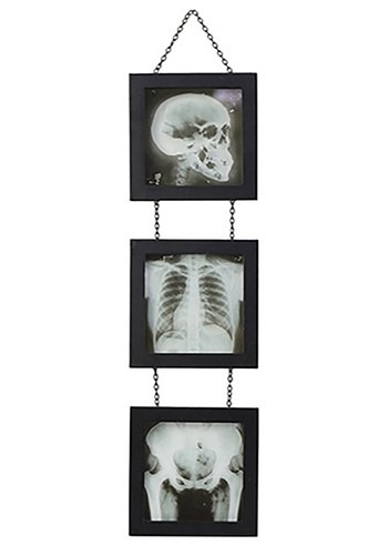 Skeleton X-Ray Wall Accent Decoration