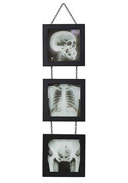 Skeleton X-Ray Wall Accent1
